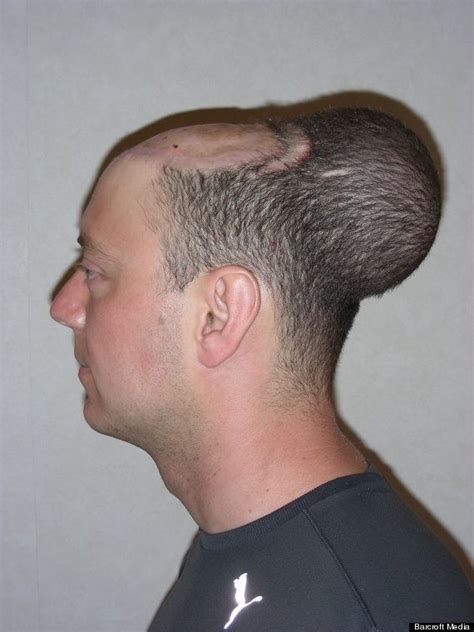 weird shaped head